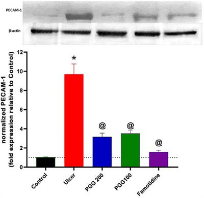 Pentagalloyl Glucose, a Major Compound in Mango Seed Kernel, Exhibits Distinct Gastroprotective Effects in Indomethacin-Induced Gastropathy in Rats via Modulating the NO/eNOS/iNOS Signaling Pathway